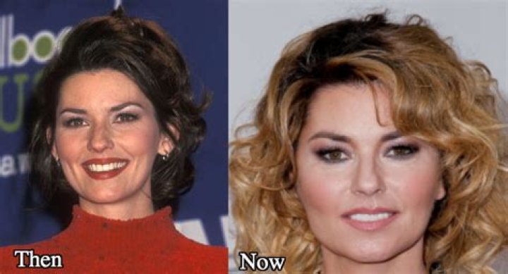 Shania Twain Before Plastic Surgery